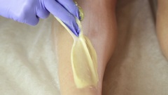 Beautician remov unwanted leg hair with shugaring. Epilation process [43025260] | 写真素材・ストックフォトのアフロ